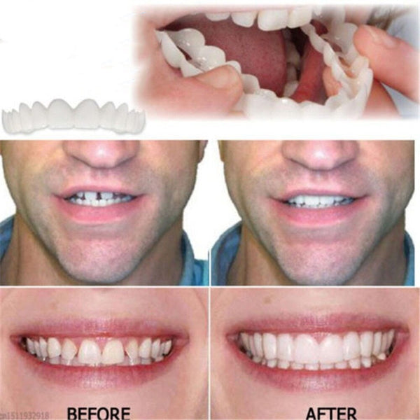 đSnap-On Dentures