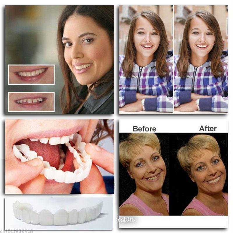 đSnap-On Dentures